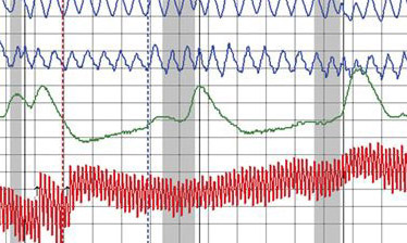 Los Angeles polygraph test real polygraph cases